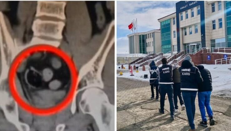 Kars'ta İranlı 3 kişinin bağırsağında uyuşturucu ele geçirildi