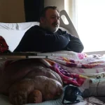 5 yıldır evden çıkamayan 300 kiloya ulaşan fil hastasının hayali; eşiyle kol kola caddede gezmek