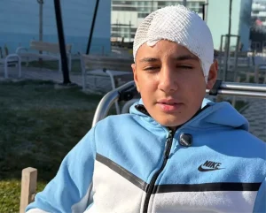 Şakalaştığı okul arkadaşı, taşla Hasan Berat’ı hastanelik etti