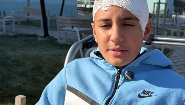 Şakalaştığı okul arkadaşı, taşla Hasan Berat’ı hastanelik etti