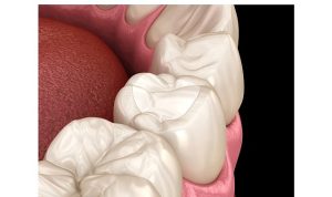 Estetik Dolguların Ömrünü Alışkanlıklarımız Belirliyor