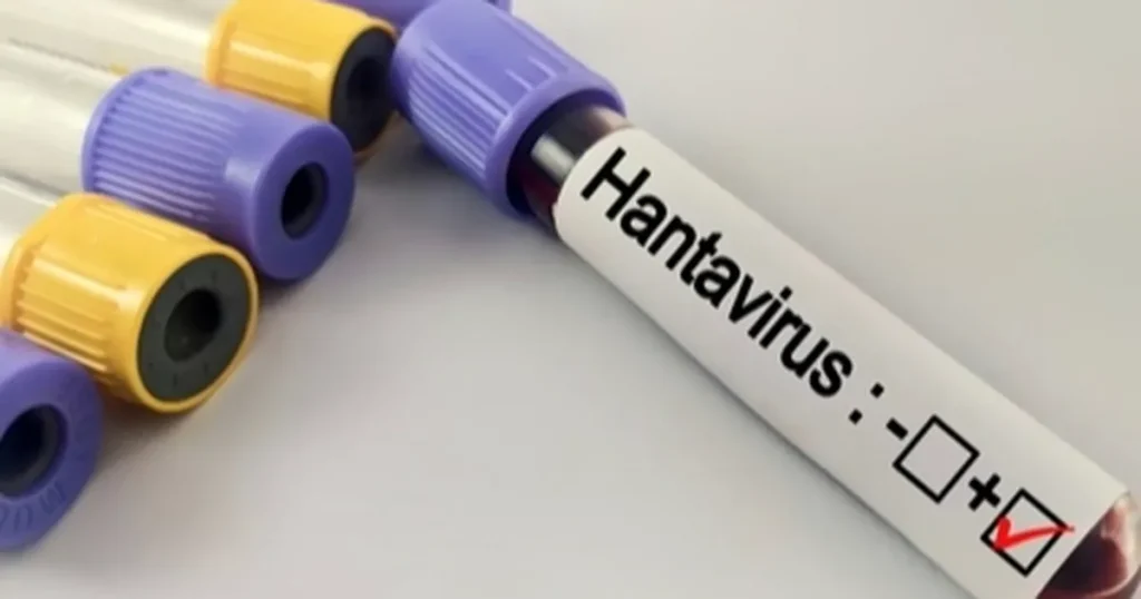 Hantavirüs Bir Salgına Dönüşür mü?