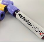 Hantavirüs Bir Salgına Dönüşür mü?